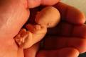 Gamete and Embryo Research - The Salvation Army New Zealand, Fiji ...