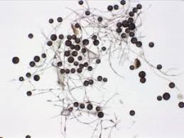 Attēlu rezultāti vaicājumam “Diderma chondrioderma sessile”