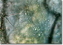 Attēlu rezultāti vaicājumam “Chironomidae imago”