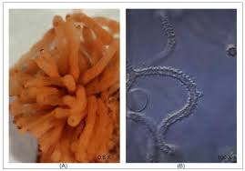 Attēlu rezultāti vaicājumam “Arcyria incarnata young”