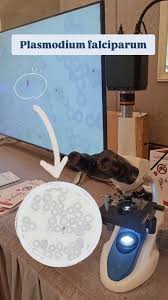 Attēlu rezultāti vaicājumam “Dianema depressum plasmodium”