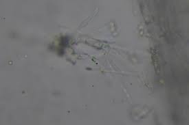 Attēlu rezultāti vaicājumam “Ombrophila violacea”