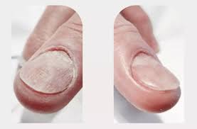Image result for lunula nail