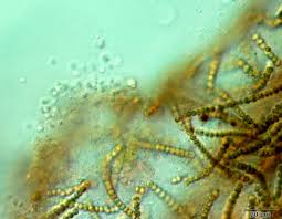 Attēlu rezultāti vaicājumam “Nostoc commune macro”