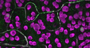 Attēlu rezultāti vaicājumam “Leiocolea rutheana cells”