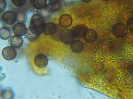 Attēlu rezultāti vaicājumam “Didymium xanthopus macro”