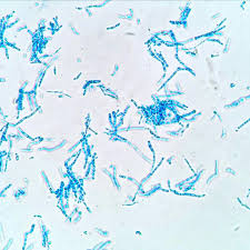 Attēlu rezultāti vaicājumam “Comatricha elegans var. microspora”