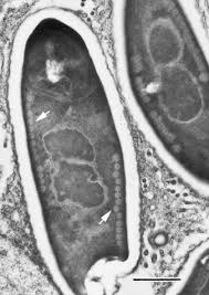 Attēlu rezultāti vaicājumam “Badhamia affinis var. microspora”
