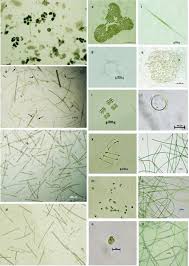 Attēlu rezultāti vaicājumam “Cyanophyta”