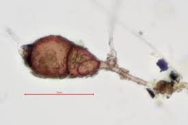 Attēlu rezultāti vaicājumam “Dicranella staphylina cells”
