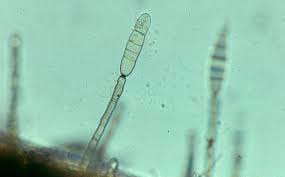 Attēlu rezultāti vaicājumam “Diderma ochraceum spores”