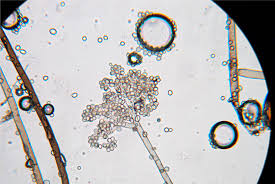 Attēlu rezultāti vaicājumam “Trichia botrytis var. cerifera spores”