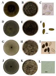 Attēlu rezultāti vaicājumam “Diderma subviridifuscum var. macrospora* spores”