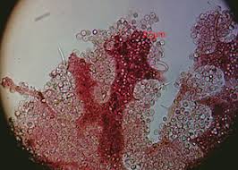 Attēlu rezultāti vaicājumam “Cribraria purpurea plasmodium”