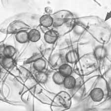 Attēlu rezultāti vaicājumam “Amaurochaete sp.”