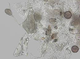 Attēlu rezultāti vaicājumam “Physarum daamsii sessile”