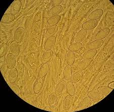 Attēlu rezultāti vaicājumam “Miladina lecithina”