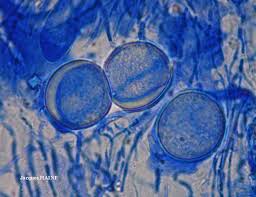 Attēlu rezultāti vaicājumam “Trichia contorta spores”