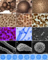 Attēlu rezultāti vaicājumam “Oligonema sp.”