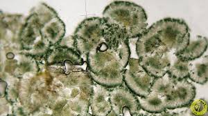 Attēlu rezultāti vaicājumam “Scoliciosporum chlorococcum”