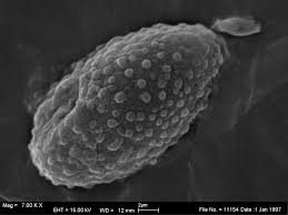 Attēlu rezultāti vaicājumam “Badhamia lilacina young”