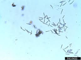 Attēlu rezultāti vaicājumam “Reticularia lobata spores”