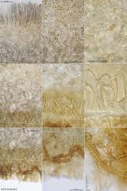 Attēlu rezultāti vaicājumam “Rutstroemia firma”