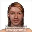 Chemical Peel recovery.png
