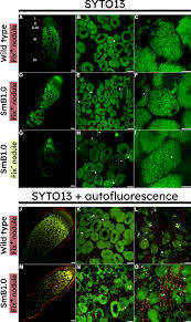 Attēlu rezultāti vaicājumam “Pseudobryum cinclidioides cells”