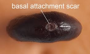 Attēlu rezultāti vaicājumam “Persicaria lapathifolia fruit”