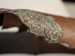 Attēlu rezultāti vaicājumam “Didymium serpula”