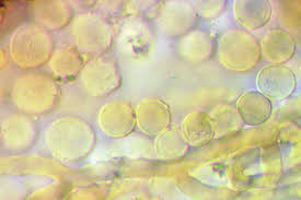 Attēlu rezultāti vaicājumam “Heterotrichia insignis (syn. Arcyria insignis) macro”