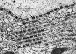 Attēlu rezultāti vaicājumam “Leiocolea rutheana cells”