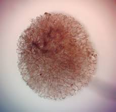 Attēlu rezultāti vaicājumam “Comatricha laxa spores”