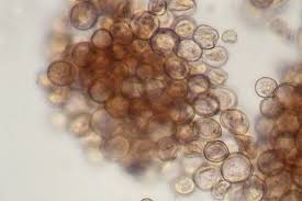 Attēlu rezultāti vaicājumam “Arcyria incarnata spores”