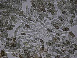 Attēlu rezultāti vaicājumam “Calicium viride”