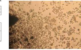 Attēlu rezultāti vaicājumam “Stemonitis axifera stalked”