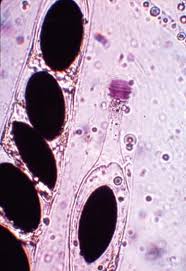 Attēlu rezultāti vaicājumam “Amaurochaete sp.”