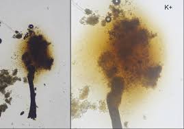 Attēlu rezultāti vaicājumam “Chaenotheca brunneola”