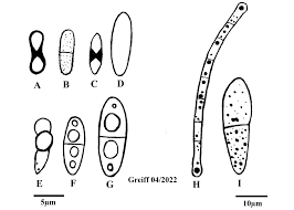 Attēlu rezultāti vaicājumam “Octosporella jungermanniarum”