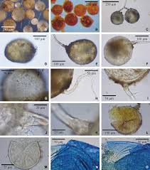 Attēlu rezultāti vaicājumam “Stemonitopsis aequalis var. microspora spores”
