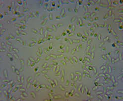 Attēlu rezultāti vaicājumam “Phlebia rufa”