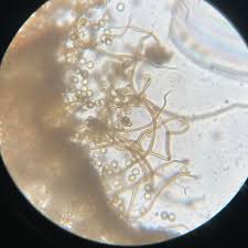 Attēlu rezultāti vaicājumam “Reticularia jurana spores”