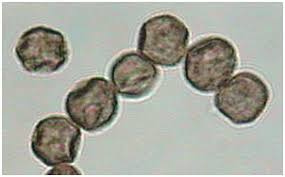 Attēlu rezultāti vaicājumam “Craterium leucocephalum spores”