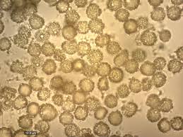 Attēlu rezultāti vaicājumam “Tulostoma fimbriatum”