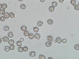 Attēlu rezultāti vaicājumam “Diderma cingulatum spores”