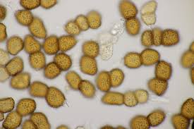 Attēlu rezultāti vaicājumam “Tranzschelia anemones”