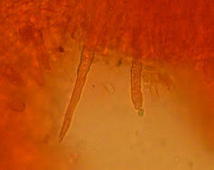Attēlu rezultāti vaicājumam “Mycoacia fuscoatra”