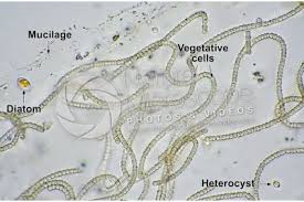 Attēlu rezultāti vaicājumam “Nostoc commune cells”