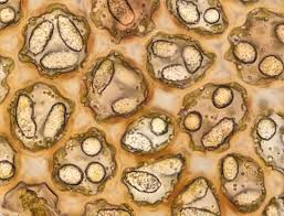 Attēlu rezultāti vaicājumam “Odontoschisma denudatum cells”